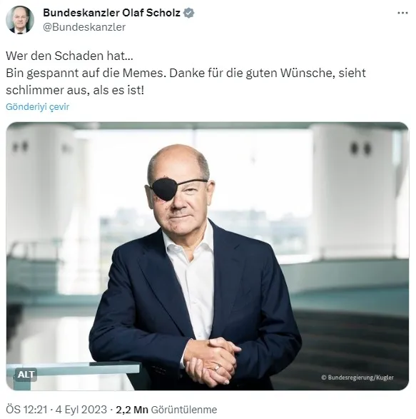yarali-yuzunu-sosyal-medyada-paylasan-olaf-scholz-viral-oldu-cilgin-kaptan-1693834891761.jpg