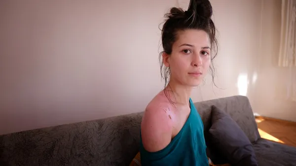 esinin-sicak-su-dokerek-hasladigi-rukiye-ayin-yurek-yakan-sozleri-bana-abla-diyor-1611992015467.jpg Eşinin sıcak su dökerek haşladığı Rukiye Ay'ın yürek yakan sözleri: Bana abla diyor-13