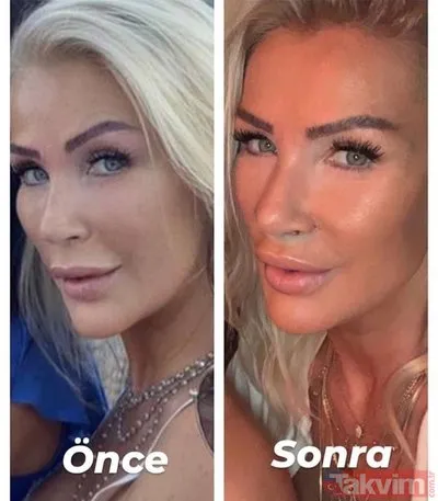 seda sayan estetiksiz hali