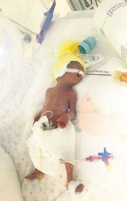 Parmak bebek mucizesi