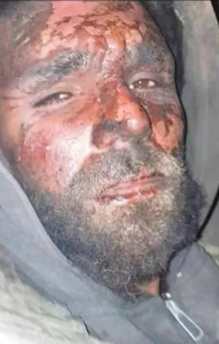 Kendi cenaze törenine sağ döndü!