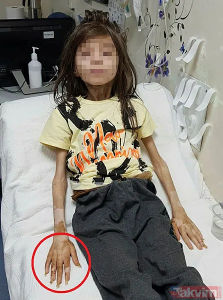 Bursa'daki çöp evde bulunan Cem Muhammet yaşadıklarını tek tek anlattı: Benden gizli yemek yiyorlardı! - 6