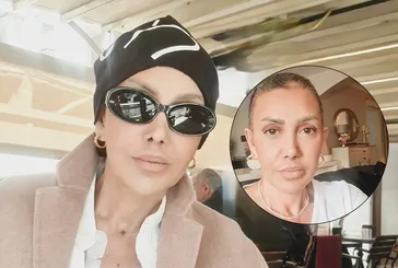 Serap Paköz meme kanserine yakalandı: Saçları dökülen sunucu hastalığı böyle duyurdu!