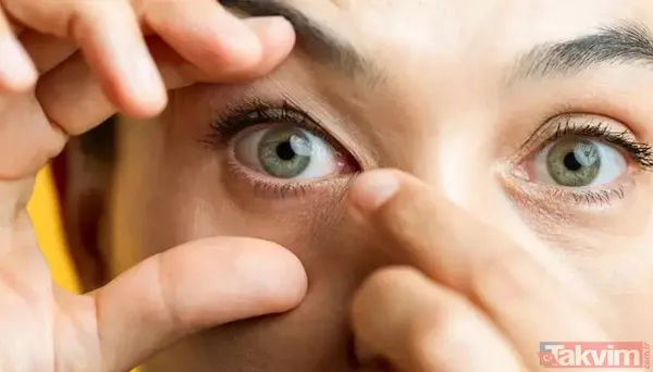 Kornea Hipoksisinin Belirtileri Neler? Hastalığın Erken Evrelerinde Belirti Vermemesi Nedeniyle Çoğu Kişi Sorunun Farkına Varmaz. Ancak İlerleyen Aşamalarda Şu...