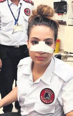 Hasta burnunu kırdı