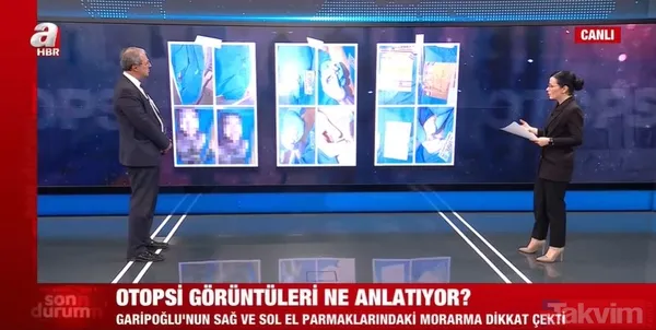 Münevver Karabulut dosyasında yeni gelişme! 10 yıl sonra Cem Garipoğlu'nun otopsi görüntüleri ortaya çıktı! Parmakları neden mordu? Uzman isim yanıtladı - 12