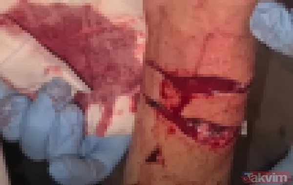 Sadece yardım etmek istemişti! Eline aldığı dev piton talihsiz adamın atardamarını parçaladı: İşte o anlar - 6