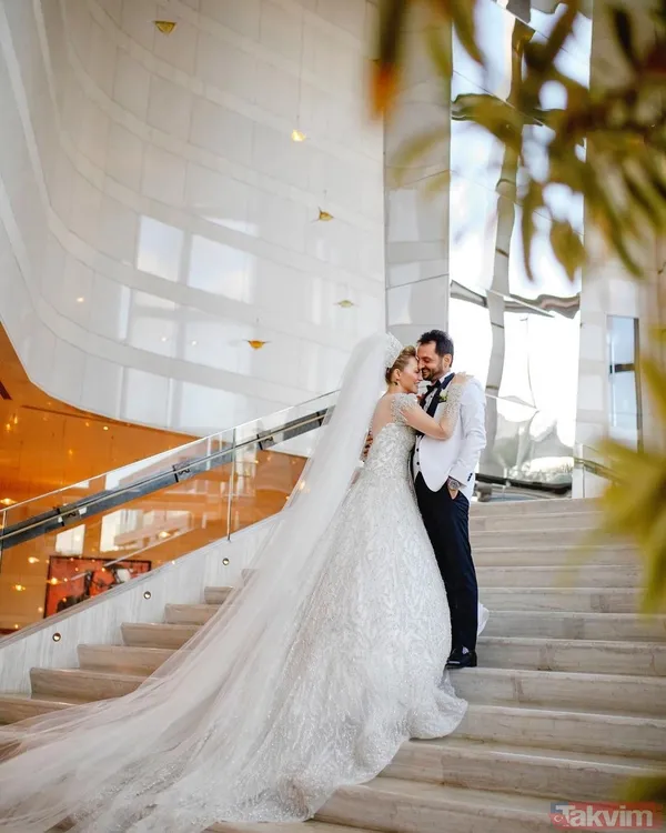 "Gelinliğim 50 - 60 Kiloydu" Gelinliği Hakkında Da Konuşan Coşkun, "Gelinliğim 50 - 60 Kiloydu. Sırf Onlar Taş İşleme. Ben Bunu Giydim Ödem Yapmaya Başladım"...