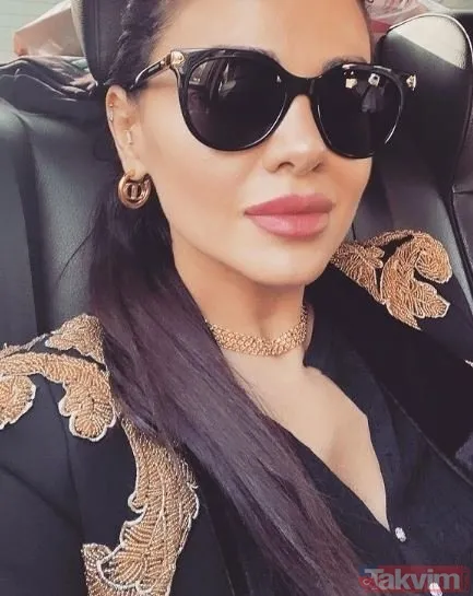 Aleyna Tilki’nin şiş dudakları olay oldu! Son halini gören dönüp bir daha baktı “Ajda Pekkan olma yolunda” - 14