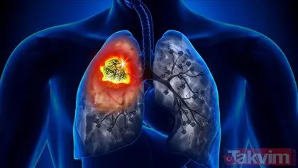 Akciğerleri yeni doğmuş gibi yapıyor tüketildiği an ciğerleriniz temizlenmeye başlıyor! Uzmanlar herkese şiddetle öneriyor
