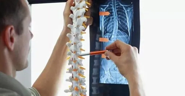 Skolyozun altın formülü