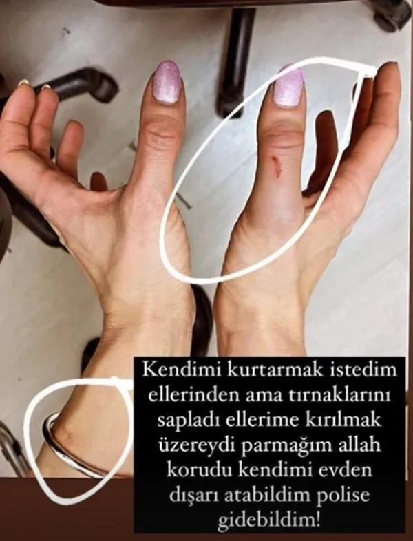 bosanmaktan-vazgecmislerdi-mihriban-hurmaci-sen-bir-canavarsin-ozer-hurmaci-dedi-kanlar-icinde-paylasti-1643995089993.jpg Boşanmaktan vazgeçmişlerdi! Mihriban Hurmacı ‘Sen bir canavarsın Özer Hurmacı’ dedi kanlar içinde paylaştı-10
