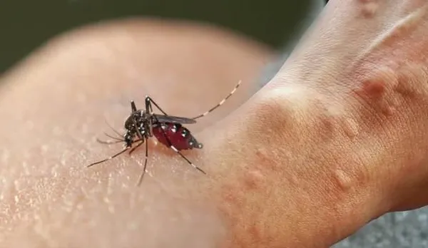 olumcul-asya-kaplan-sivrisinegi-istanbulu-mesken-tuttu-ibb-uyarilari-dikkate-almadi-1629526995385.jpg Ölümcül Asya Kaplan Sivrisineği İstanbul'u mesken tuttu! İBB uyarıları dikkate almayınca...-4