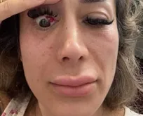 İstanbul’da fitness eğitmeni tavuk dönerden zehirlendi!