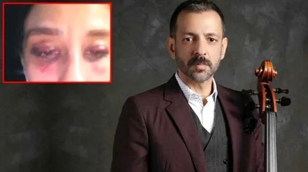 SON DAKİKA: Rubato'nun solistinin şiddet davasında mütalaa! Özer Arkun'un beş yıla kadar hapsi istendi-5