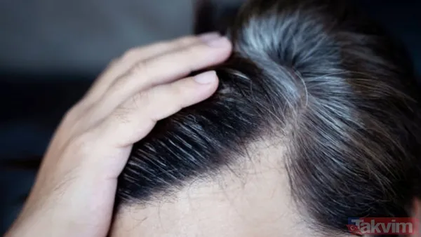 Saçlarınız neden erken beyazlıyor? Genetik mi, stres mi? Cevabı şaşırtacak… - 1