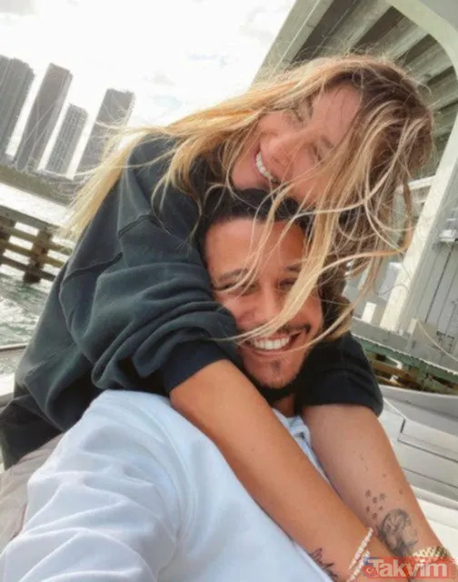 Acun Ilıcalı'nın yüzü gözü morluk içinde gören darp edildi sanıyor ama işin aslı başka! Estetik mi derken... - 47