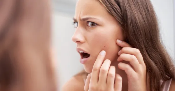 Sivilce patlatmak orucu bozar mı?