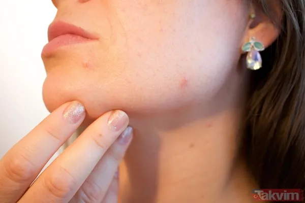 🔁 Uygulama Süresi Ve Etki Saraçoğlu, Kürün Etkili Olabilmesi İçin 3 Defa 15'Er Günlük Periyotlarla Uygulanmasını Öneriyor. Yani Toplamda 45 Günlük Bir Süreçte...