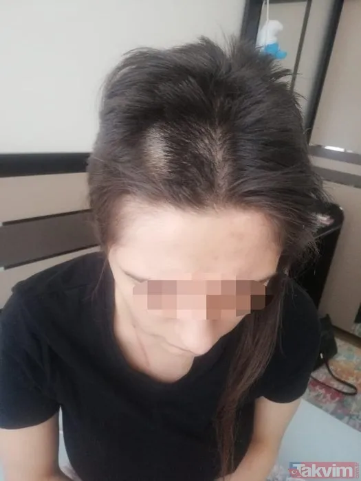 Konya'da iki kadın tarafından kaçırılıp işkence edilen Demet A dehşet anlarını anlattı! 'Evden çıkamayacağım sandım' - 27