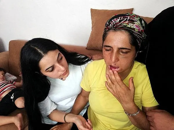 hatayda-22-yildir-esinden-siddet-goren-hatice-cok-korkuyorum-1596296923313.jpeg Hatay'da 22 yıldır eşinden şiddet gören Hatice: Çok korkuyorum-3