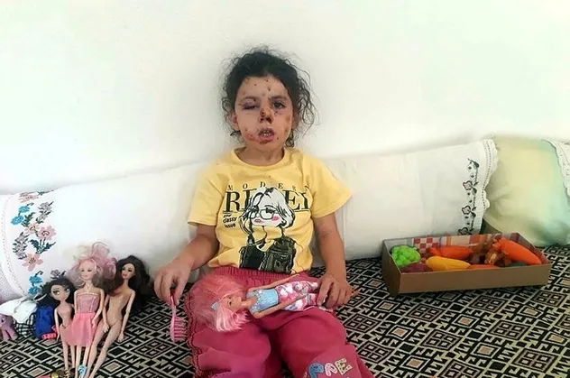 İzmir’de maganda dehşeti! 5 yaşındaki Neriman'ı bu hale getirdiler