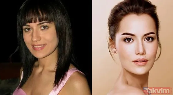 10 yıl önceki hallerini görenler tanıyamıyor! Hangi ünlüde burun estetiği var? Hande Erçel, Şeyma Subaşı, Gökçe Bahadır... Liste kabarık! - 3
