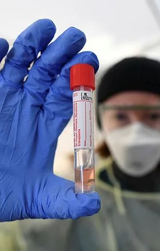 Kovid-19 için ‘yerli ve milli’ test kitleri geliştiriliyor