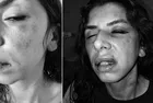 Çekmeköy'de kadına şiddet! Karısını öldüresiye döven koca tutuklandı