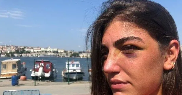 Eski mankene gece kulübünde öldüresiye dayak! Kan donduran görüntü: Gizem Akbaş’a şiddet anı kamerada