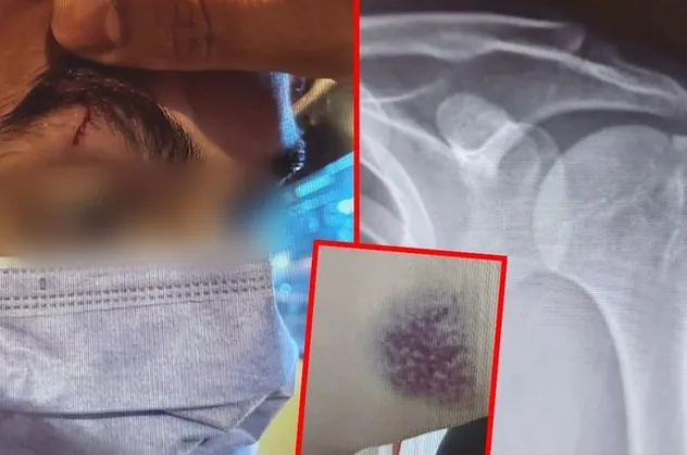 İETT şoföründen yolculara skandal sözler: ‘Susun lan kafamız şişti’ diye bağırıp…