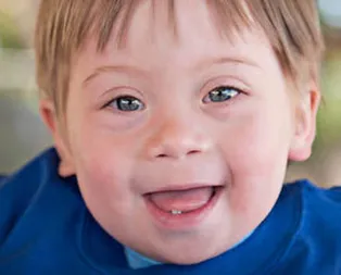 21 Mart Down Sendromu Farkındalık Gününün önemi nedir?