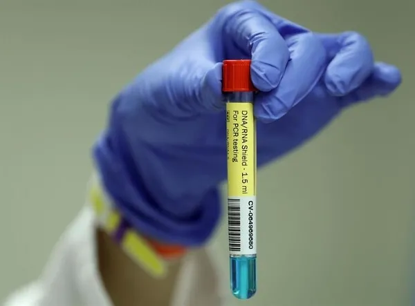 Rusya'nın koronavirüs aşısına ilk sipariş Vietnam'dan geldi!-5