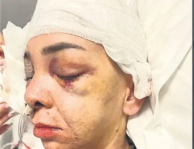 Kocaeli’de eğlence mekanında dehşet: Anne ve oğlunu darp eden şüphelilerin ifadesi ortaya çıktı