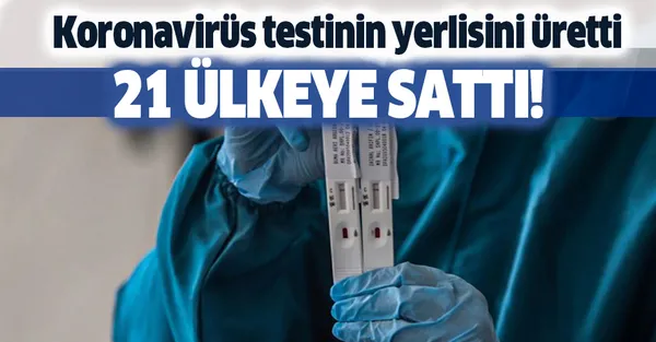 Son dakika: Koronavirüs testinin yerlisini üretti! 21 ülkeye sattı-1