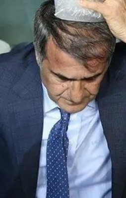 İşte Şenol Güneş'in kafasındaki yaranın en net görüntüsü!