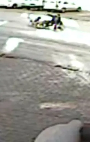 Ankara’da başıboş köpeklerin saldırdığı Ramazan Aslan: “Arkamı döndüm köpekler bacağıma saldırıp etimi kopardı”