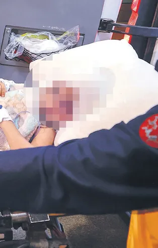 Gaziantep'te Pitbull saldırsına uğrayan minik A.A yüz felci için bir ameliyat daha olacak