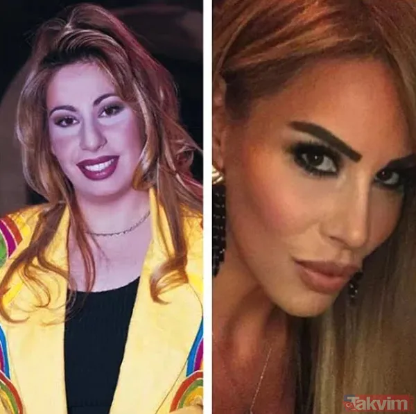 Linet'in eski kilolu ve estetiksiz halleri ağızları açık bırakıyor! Linet yıllar geçtikçe gençleşmiş - 11