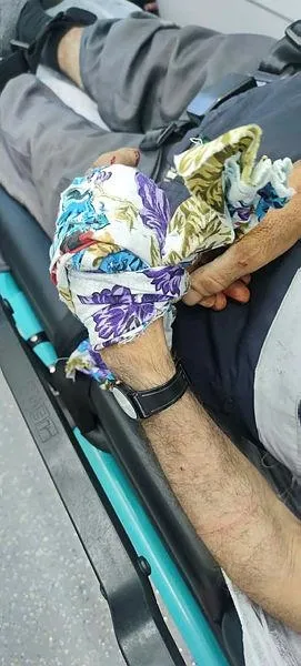 Sahipsiz köpek dehşetinin adresi bu sefer Diyarbakır! Sokak köpekleri yaşlı adama saldırdı-1