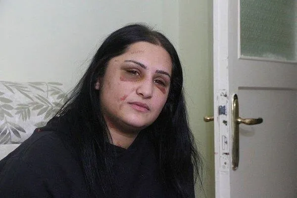 SON DAKİKA: Samsun'daki kadına şiddet olayının faili İbrahim Zarap için ‘Kasten öldürmeye teşebbüs’ten 18 yıl-2
