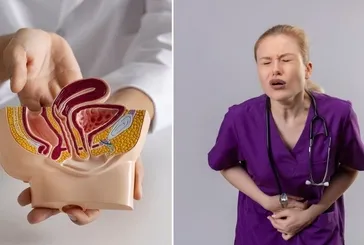 Karın ağrısı, şişkinlik, ishal! Kolon kanserinin gizli sinyalleri ortaya çıktı: Bağırsaklarda sinsice ilerleyip...