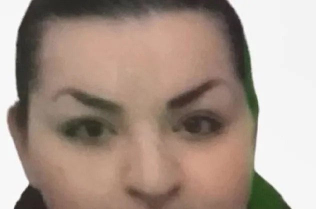 Yağ aldırmak için Türkiye'ye gelen yabancı kadının sır ölümü