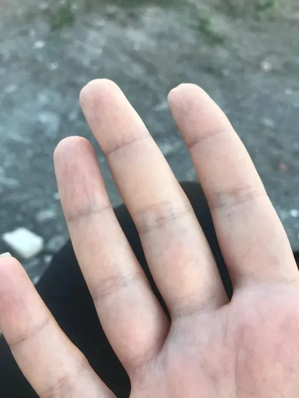 elleriniz-hep-usuyorsa-nedeni-bu-olabilir-1-dakikada-raynaud-hastaligi-testi-1731849011510.jpeg 1 dakikada Raynaud hastalığı testi: Elleriniz hep üşüyorsa nedeni bu olabilir!-4