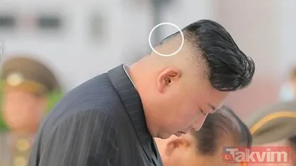 SON DAKİKA: Dünyanın konuştuğu fotoğraf! Kim Jong-un’un ensesinde kocaman bir yara bandı var