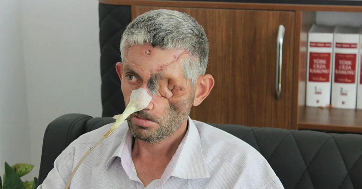 gunlerce dis agrisi cekip doktora gitti sonrasi korkunc