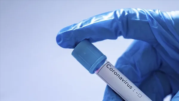 koronavirus-damarlarda-da-pihti-ihtimalini-artiriyor-1605342267817.jpg Koronavirüs damarlarda da pıhtı ihtimalini artırıyor-6