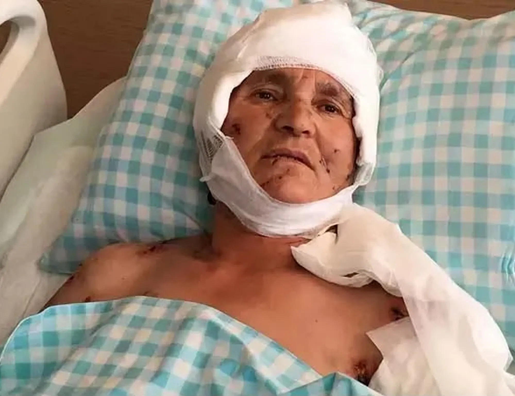 Yargıtay’dan emsal karar: Köpek saldırısında yaralanan kadına 637 bin lira tazminat kararı