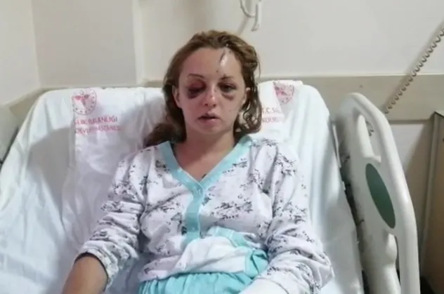 5 gün sonra yoğun bakımdan çıktı: İfadesi kan dondurdu