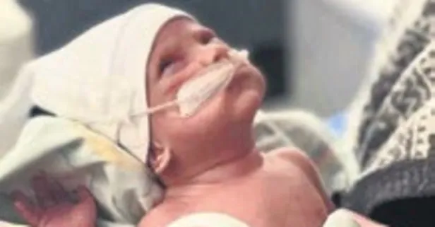 600 gram doğan Asil Ata 98 günün ardından hayata tutundu